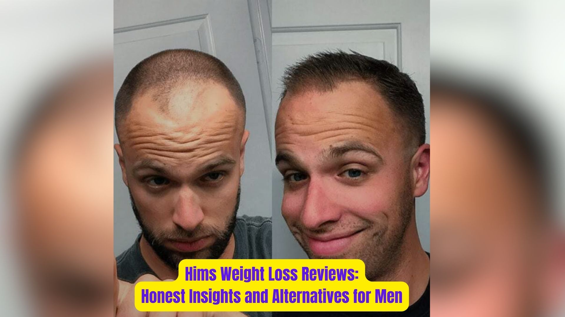 Hims Weight Loss Reviews:Honest Insights and Alternatives for Men