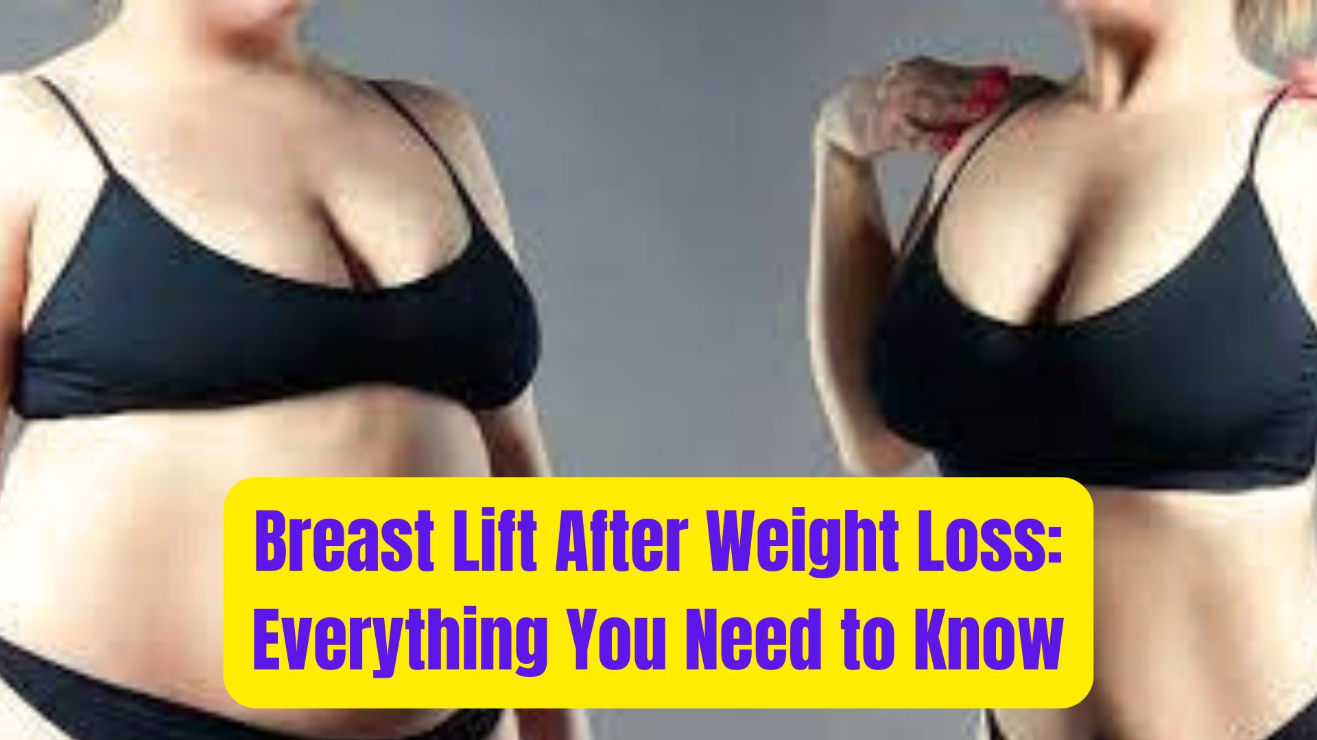 Breast Lift After Weight Loss Everything You Need to Know